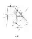 Fig. 04 - Reformer exercise apparatus