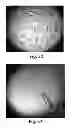 Fig. 45 - METHODS AND COMPOSITIONS FOR CELL-PROLIFERATION-RELATED DISORDERS