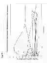 Fig. 07 - Method for the diagnosis of Gaucher's disease