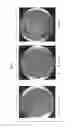 Fig. 02 - Ligation enhancement