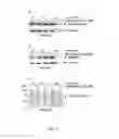 Fig. 05 - PHARMACEUTICAL COMPOSITIONS FOR THE TREATMENT OF CONDITIONS RESPONSIVE TO PROTEASOME INHIBITION