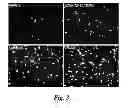 Fig. 04 - Compounds and methods of use thereof for treating neurodegenerative disorders