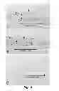 Fig. 03 - Methods of modulating compliance of the trabecular meshwork