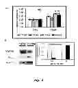 Fig. 05 - Methods of modulating compliance of the trabecular meshwork
