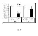 Fig. 07 - Methods of modulating compliance of the trabecular meshwork