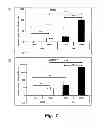 Fig. 08 - Methods of modulating compliance of the trabecular meshwork