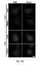 Fig. 14 - Methods of modulating compliance of the trabecular meshwork