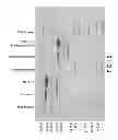 Fig. 13 - Purification of fusion proteins