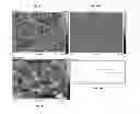 Fig. 12 - ANTIGENIC COMPOSITIONS AND USE OF SAME IN THE TARGETED DELIVERY OF NUCLEIC ACIDS