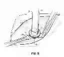 Fig. 05 - DEVICES, METHODS AND SYSTEMS FOR COUNTERPULSATION AND BLOOD FLOW CONDUIT CONNECTION