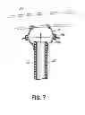 Fig. 07 - DEVICES, METHODS AND SYSTEMS FOR COUNTERPULSATION AND BLOOD FLOW CONDUIT CONNECTION