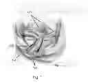 Fig. 02 - Methods, compositions and kits for surgical repair