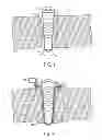 Fig. 02 - Apparatus and Methods for Enhanced Visualization and Control in Minimally Invasive Surgery