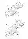 Fig. 02 - Physiological sensor having a waist