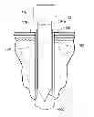 Fig. 01 - Surgical access system with navigation element and method of using same