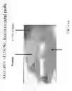 Fig. 46 - Radioactive-emission-measurement optimization to specific body structures