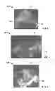 Fig. 04 - Systems and methods for ultrasound image rendering