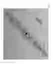 Fig. 04 - Body-worn sensor for characterizing patients with heart failure