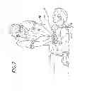 Fig. 07 - ECG Artifact Reduction System