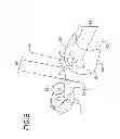 Fig. 08 - ECG Artifact Reduction System