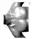 Fig. 06 - Body-worn sensor for characterizing patients with heart failure