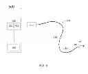 Fig. 09 - Pressure-sensing guide wire with sliding pressure sensor
