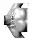 Fig. 06 - Body-worn sensor for characterizing patients with heart failure