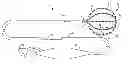 Fig. 01 - Artifact cancellation to suppress far-field activation during electrophysiology mapping
