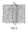 Fig. 06 - Artifact cancellation to suppress far-field activation during electrophysiology mapping