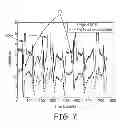Fig. 07 - Artifact cancellation to suppress far-field activation during electrophysiology mapping