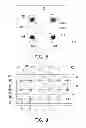 Fig. 06 - ELECTRODE PATCH MODULE AND CHRONIC PAIN DETECTION METHOD AND APPARATUS THEREOF