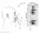 Fig. 01 - Breathing disorder identification, characterization and diagnosis methods, devices and systems