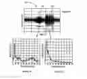 Fig. 09 - Breathing disorder identification, characterization and diagnosis methods, devices and systems