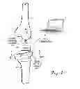 Fig. 02 - Small form factor medical sensor structure and method therefor
