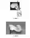 Fig. 08 - Devices, systems, and methods for determining linear and angular accelerations of the head