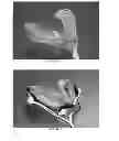 Fig. 22 - Devices, systems, and methods for determining linear and angular accelerations of the head
