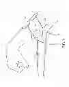 Fig. 09 - Method and apparatus for applying neuromuscular electrical stimulation
