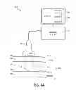 Fig. 03 - ENERGY-BASED TISSUE TIGHTENING SYSTEM