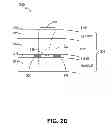 Fig. 06 - ENERGY-BASED TISSUE TIGHTENING SYSTEM
