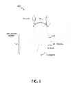 Fig. 13 - ENERGY-BASED TISSUE TIGHTENING SYSTEM