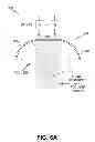 Fig. 14 - ENERGY-BASED TISSUE TIGHTENING SYSTEM