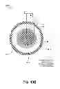 Fig. 20 - ENERGY-BASED TISSUE TIGHTENING SYSTEM