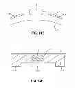 Fig. 22 - ENERGY-BASED TISSUE TIGHTENING SYSTEM