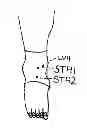 Fig. 01 - Acupuncture Point Stimulating Compression Garment for Treatment of Musculoskeletal and Joint Pains