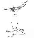 Fig. 02 - Acupuncture Point Stimulating Compression Garment for Treatment of Musculoskeletal and Joint Pains
