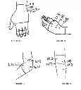 Fig. 08 - Acupuncture Point Stimulating Compression Garment for Treatment of Musculoskeletal and Joint Pains