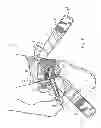 Fig. 08 - Ankle stabilizing device comprising an above-the-foot body member and integrated flexible non-stretch ankle belt