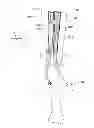 Fig. 01 - Devices, systems, and methods for peripheral arteriovenous fistula creation