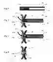 Fig. 07 - Devices, systems, and methods for peripheral arteriovenous fistula creation