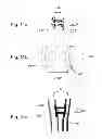 Fig. 09 - Devices, systems, and methods for peripheral arteriovenous fistula creation